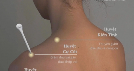 4 Huyệt vùng cổ vai gáy giúp giảm đau mỏi & khơi thông khí huyết