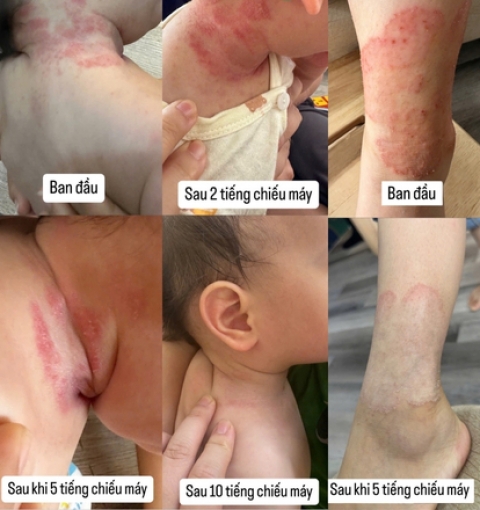 Hỗ trợ các bệnh về da